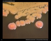 desoxycholate agar